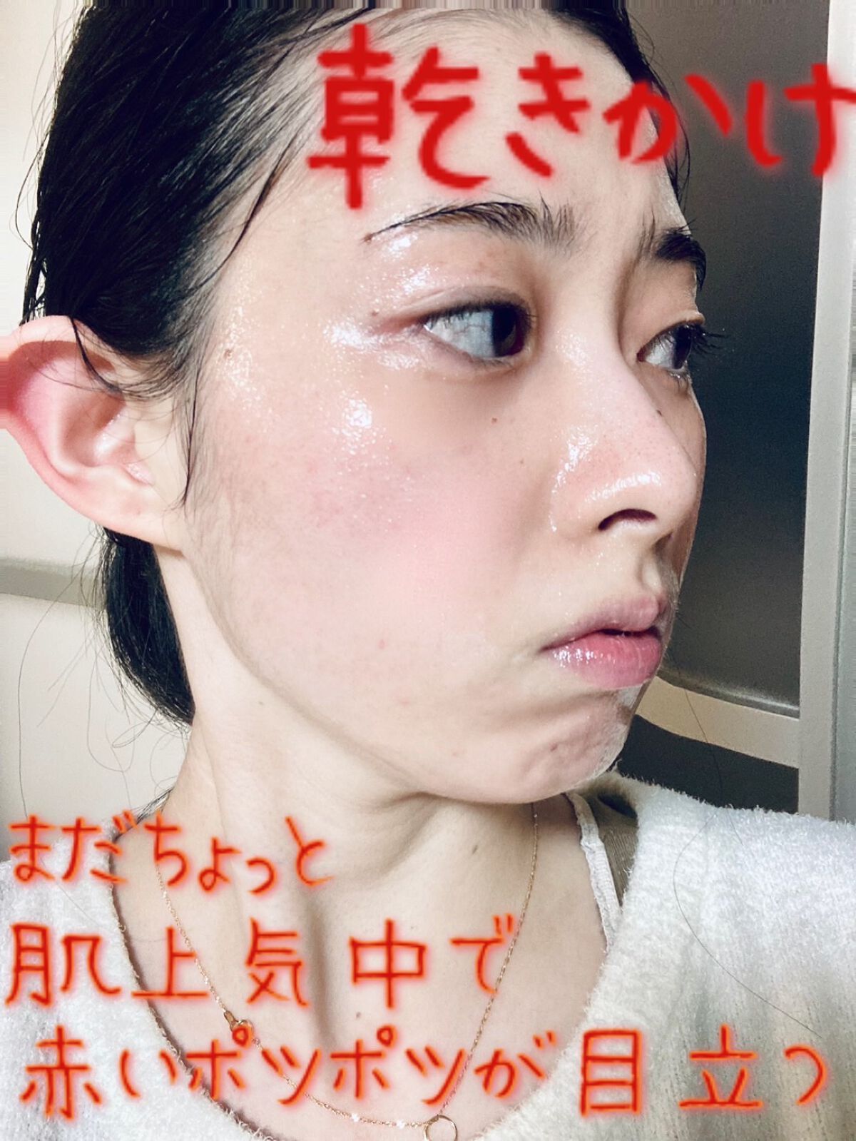 毛穴小町 イエローピールオフパック/クリアターン/ピーリングを使ったクチコミ（3枚目）