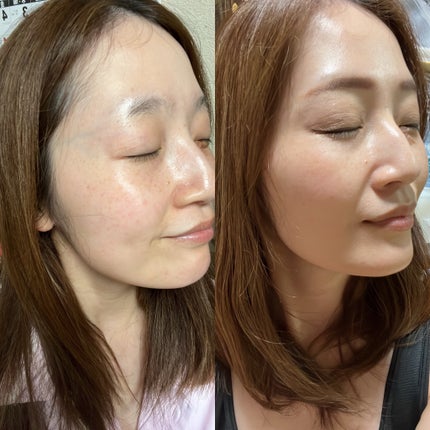 ピンクティーツリーカバークッション/APLIN/クッションファンデーションを使ったクチコミ(1枚目)