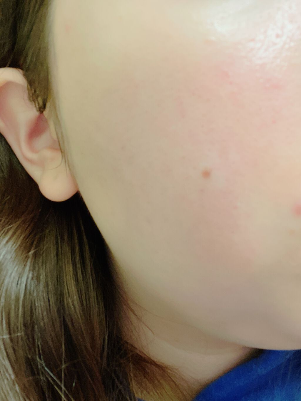 薬用しみ集中対策 プレミアム美容液/メラノCC/美容液を使ったクチコミ(2枚目)