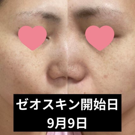 ミラミックス/ZO Skin Health/フェイスクリームを使ったクチコミ(3枚目)