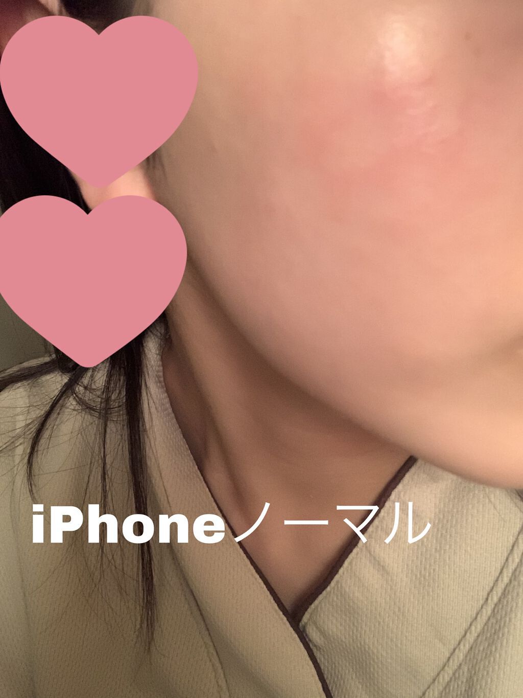 オロナインＨ軟膏 (医薬品)/オロナイン/その他を使ったクチコミ（2枚目）