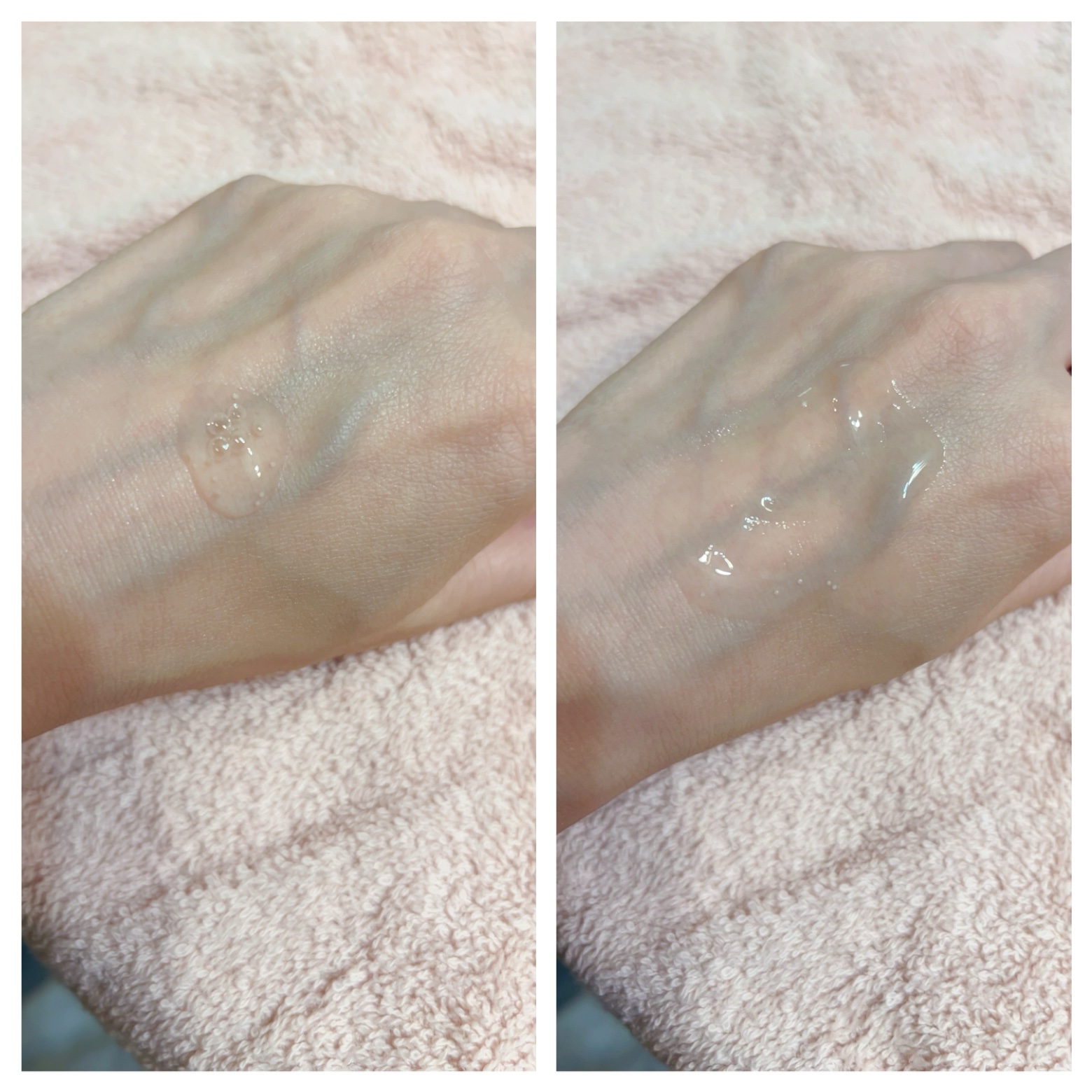 トーンブライトニング カプセルアンプル/SKIN1004/美容液を使ったクチコミ（2枚目）