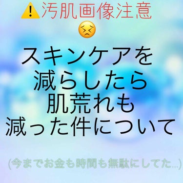 お久しぶりです、凜音です！

ＧＷ、前半は大会に模試にと忙しかったのですが後半はようやくゆっくり過ごせそうなのでほっとしています☺️

いきなりですが、わたし、慢性的なニキビ肌でして😢小学校高学年~高校