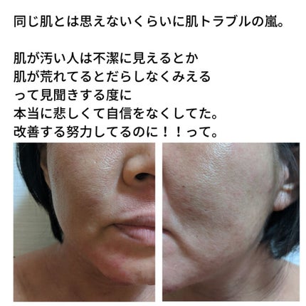 を使ったクチコミ(3枚目)