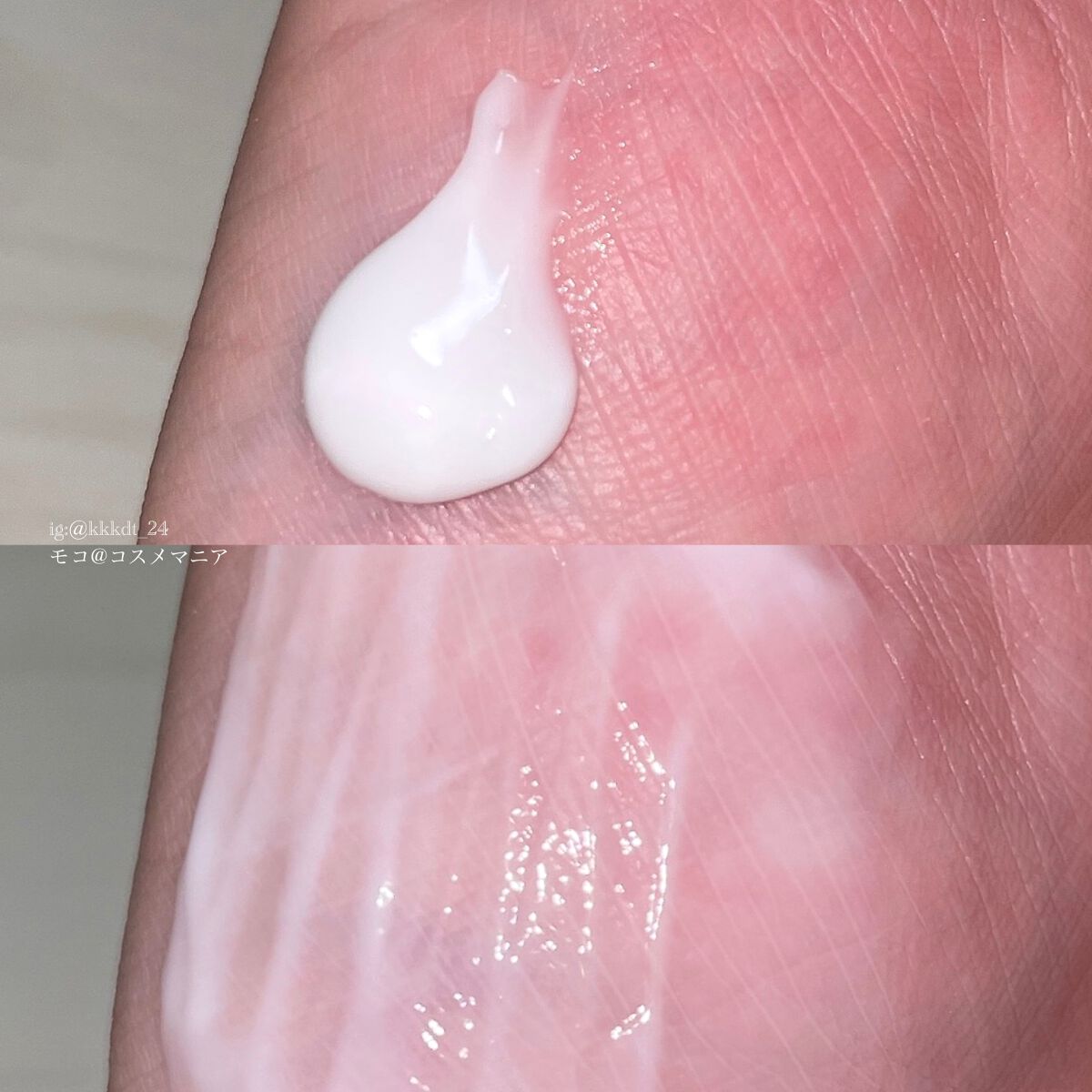 DMT インテンシブフェイシャルクリーム/PHYSIOGEL/フェイスクリームを使ったクチコミ(5枚目)