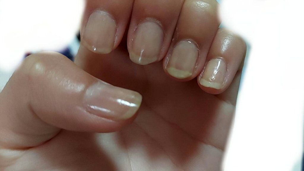 ウィンマックス ネイルケアシリーズ ベースコート/DAISO/ネイルベースコートを使ったクチコミ(6枚目)