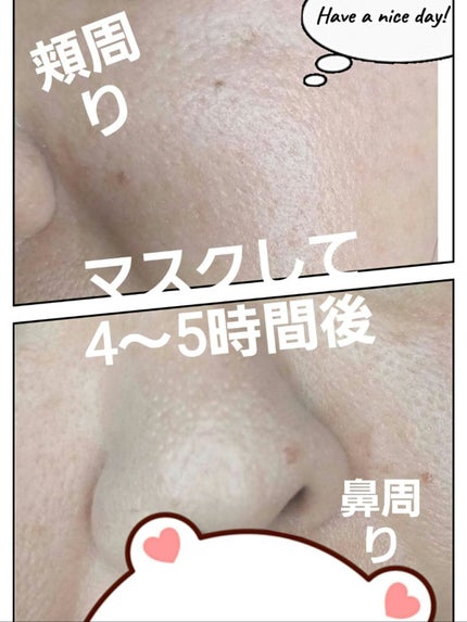 (旧)アンリミテッド ラスティング フルイド/shu uemura/リキッドファンデーションを使ったクチコミ(3枚目)