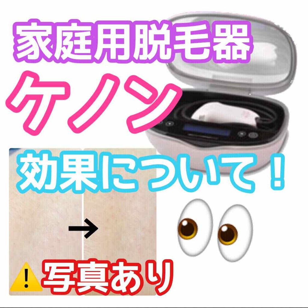 光美容器KE-NON(ケノン)/エムテック/家庭用脱毛器を使ったクチコミ(1枚目)
