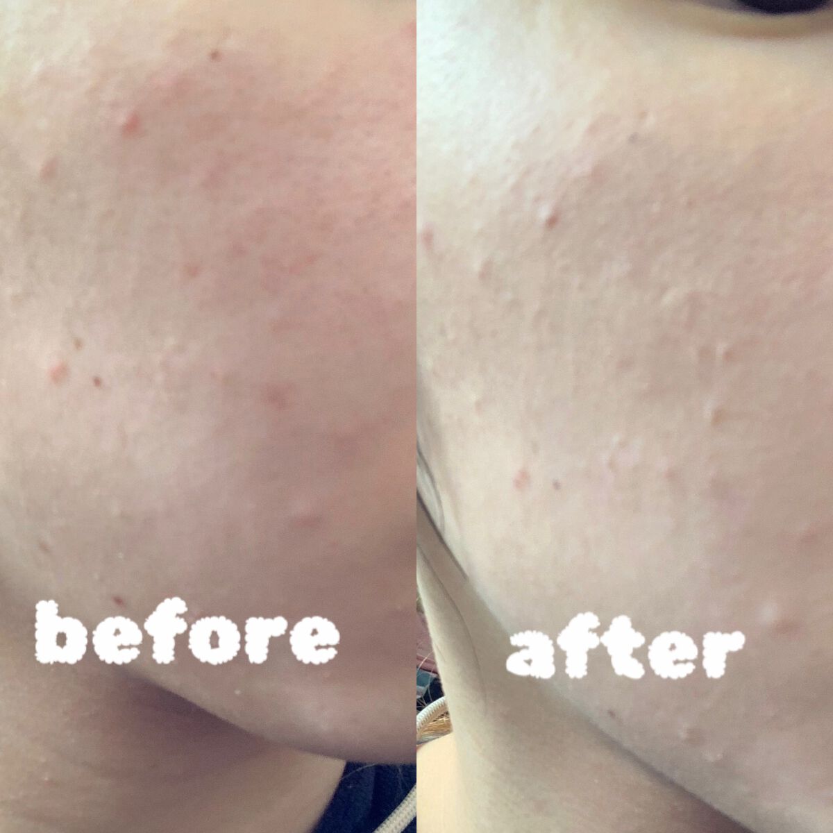 ãã©ããã£ãã¯ããŠããªãŒ EX/ããã¢ãŒãžã¥/ããŠããŒãã¡ã³ããŒã·ã§ã³ã䜿ã£ãã¯ãã³ãïŒ2æç®ïŒ