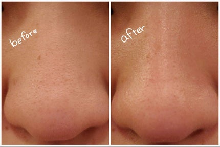 美容化粧液/はしかた化粧品/化粧水を使ったクチコミ(5枚目)