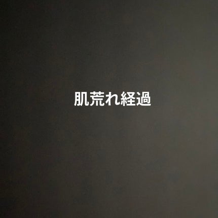 ra on LIPS 「7月19日お風呂上がりでスキンケアしてべピオゲル塗って1時間後..」(1枚目)