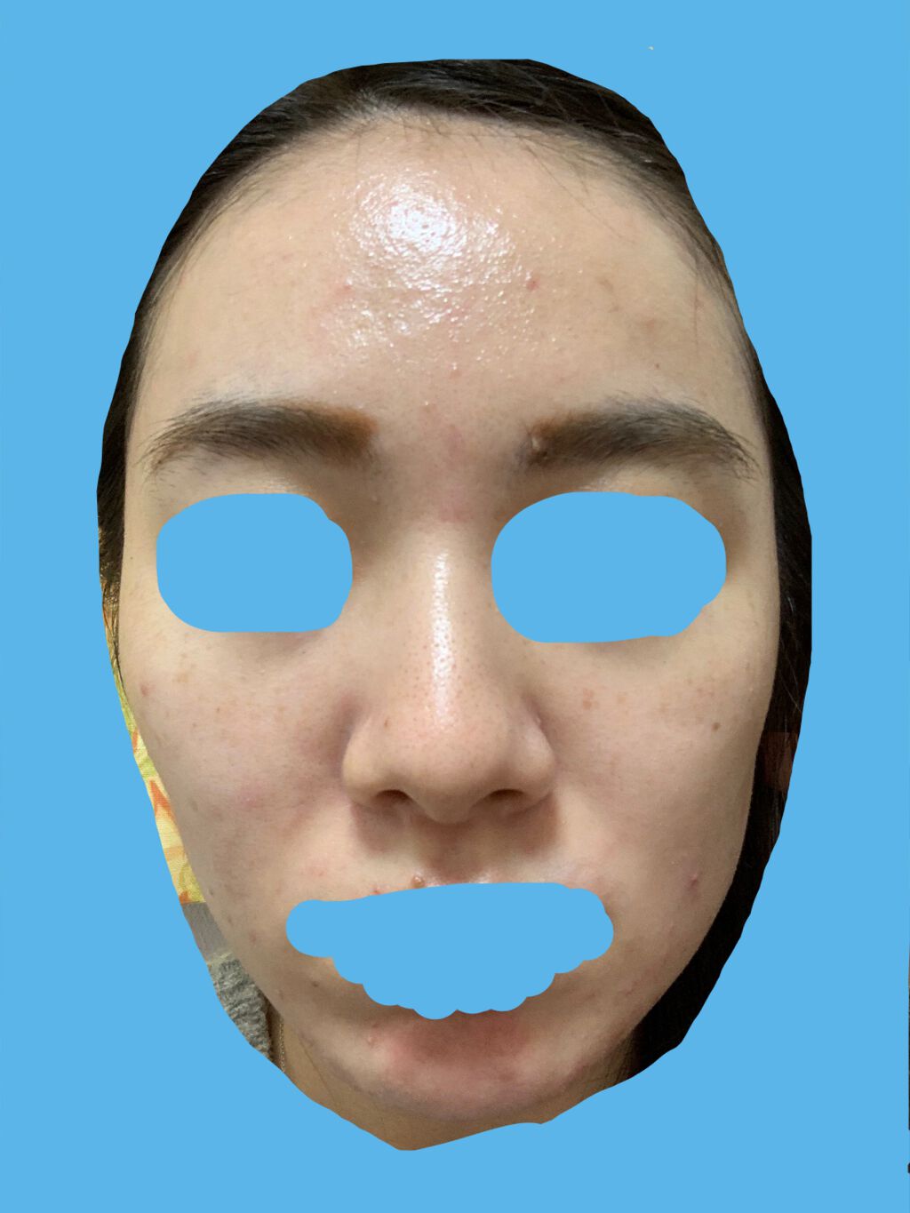 潤浸保湿 化粧水 III とてもしっとり/キュレル/化粧水を使ったクチコミ(1枚目)