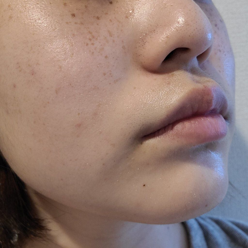 スペシャルジェルクリームA (ホワイト)(医薬部外品)/アクアレーベル/オールインワン化粧品を使ったクチコミ(2枚目)