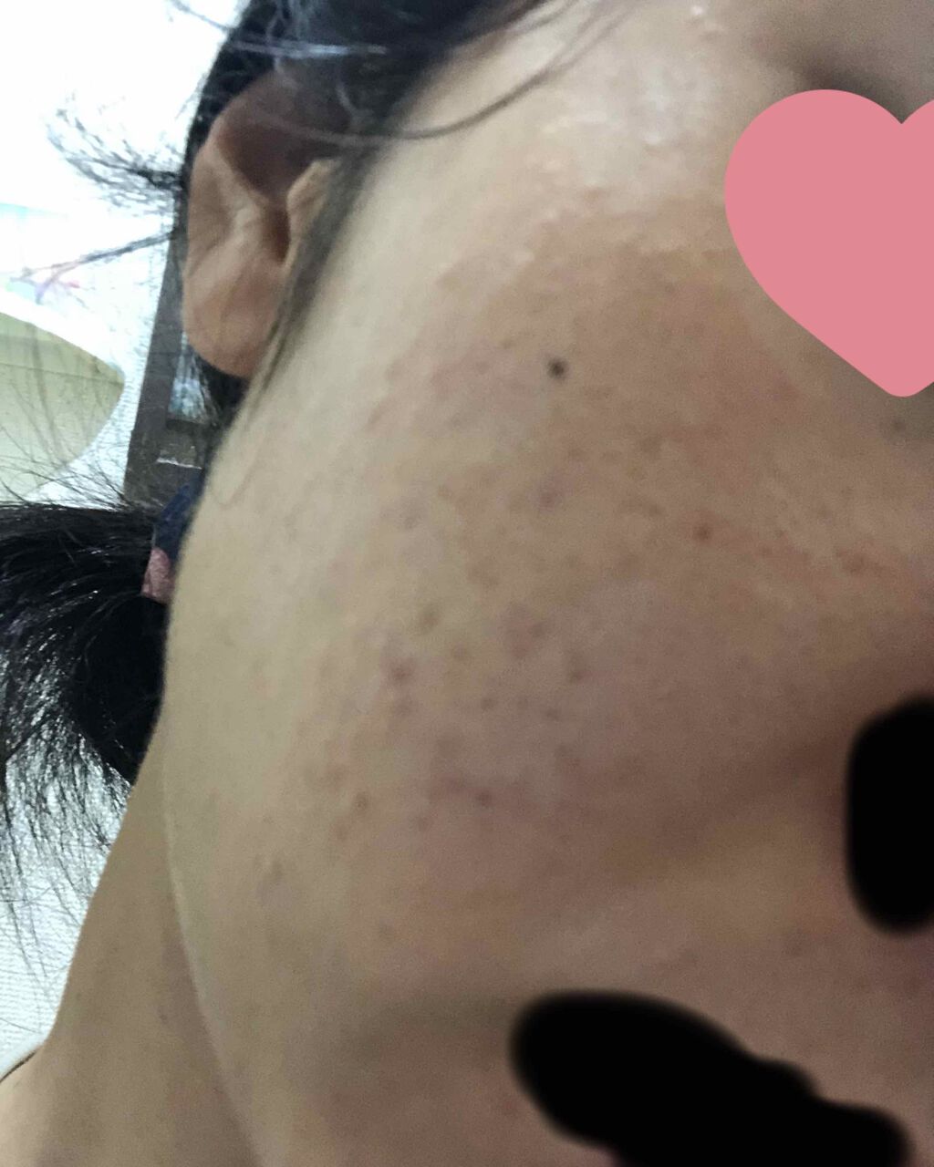 敏感肌用薬用美白美容液/無印良品/美容液を使ったクチコミ（2枚目）