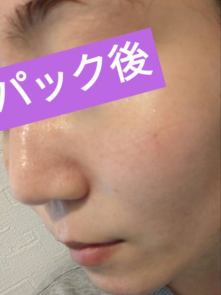 ジョワセリュール フェイスマスク/JOIE CELLULE/シートマスク・パックを使ったクチコミ(4枚目)