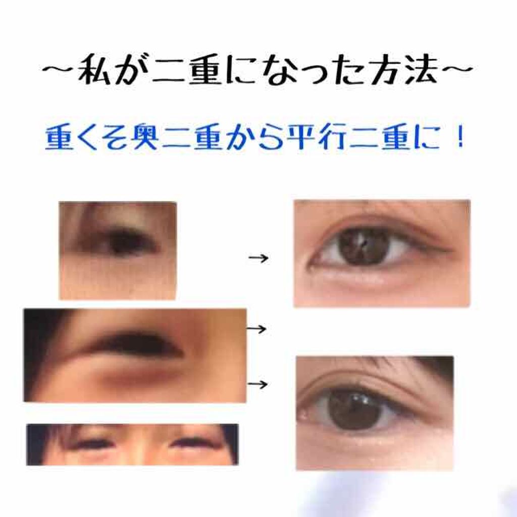 二重になる方法 アイテープ 埋没式両面テープ Daisoの使い方や二重メイク 皆さん こんにちは 透 By 透明 敏感肌 Lips