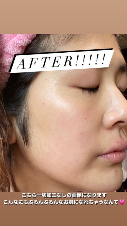 ルルルンピュア エブリーズ/ルルルン/シートマスク・パックを使ったクチコミ(4枚目)