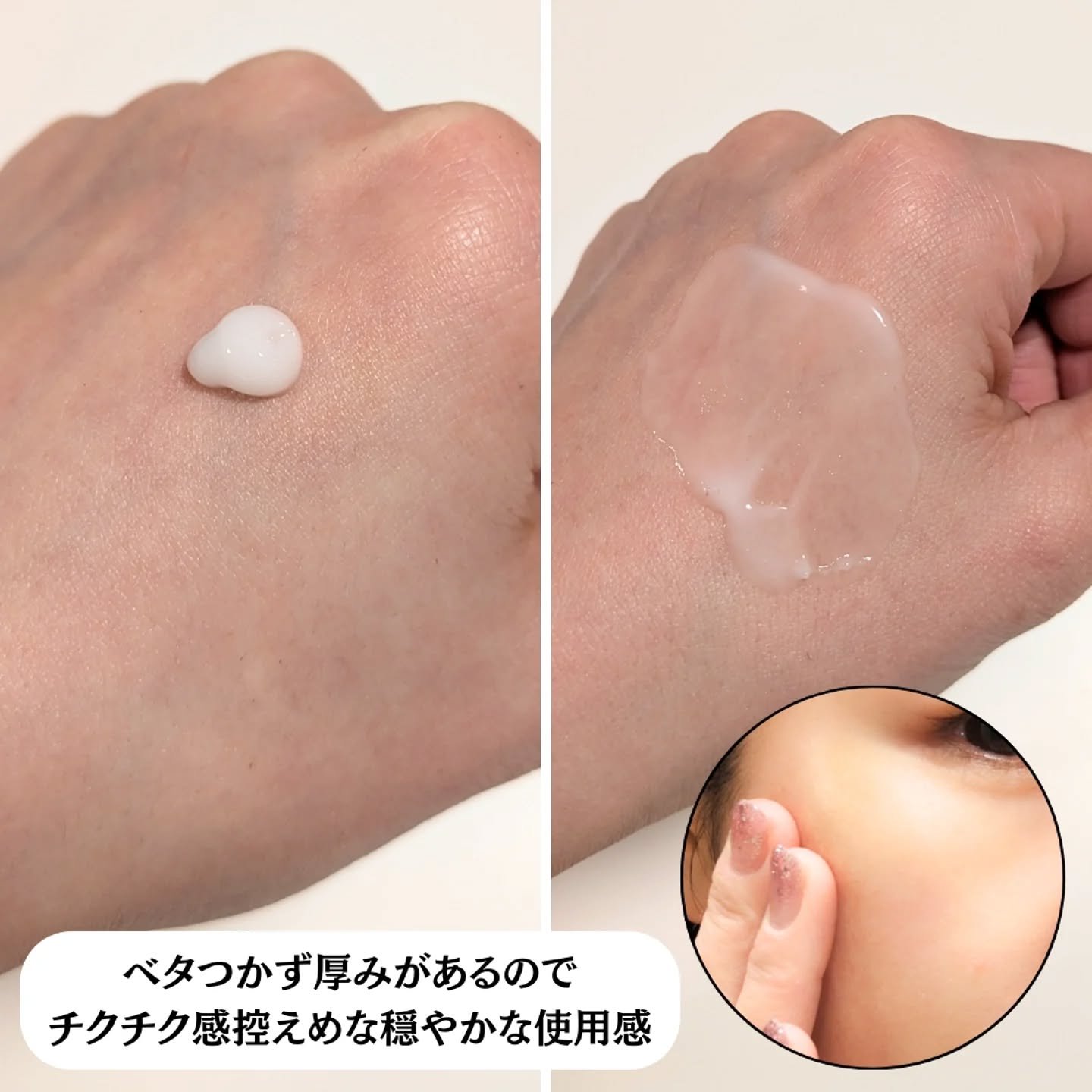 パーフェクトニードルプレミアム/FABIUS/美容液を使ったクチコミ（3枚目）