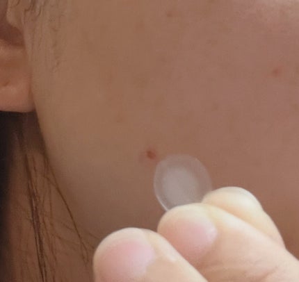 プロCICA クリアスポットパッチ/VT/その他スキンケアを使ったクチコミ(6枚目)