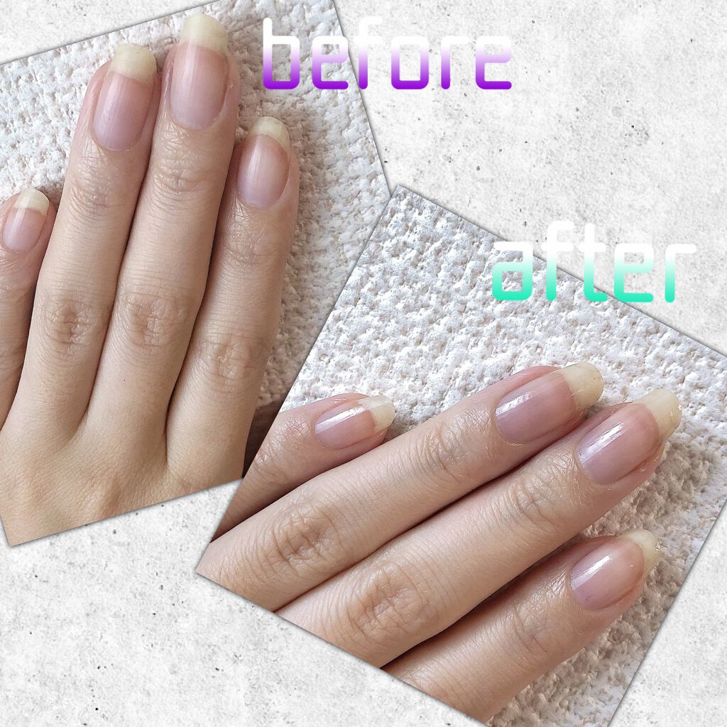 エテュセ クイックケアコート PU/ettusais/ネイルオイル・トリートメントを使ったクチコミ（2枚目）