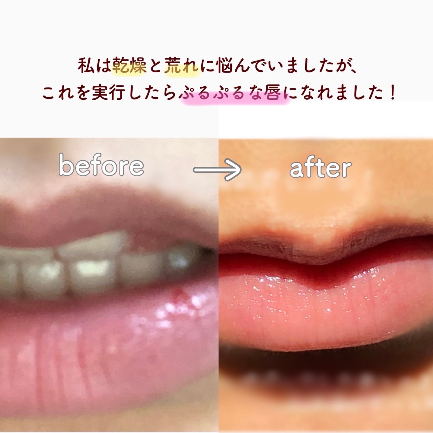 DHC 薬用リップクリーム/DHC/リップクリームを使ったクチコミ(2枚目)