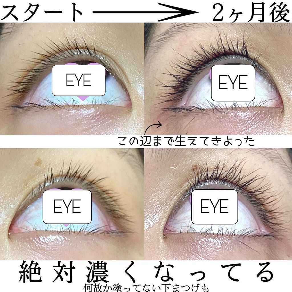 EMAKED(エマーキット)/水橋保寿堂製薬/まつげ美容液を使ったクチコミ(2枚目)