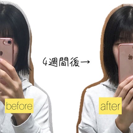 ヘアアクセルレーターEX フローラルアップルの香り/加美乃素本舗/頭皮ローションを使ったクチコミ(4枚目)