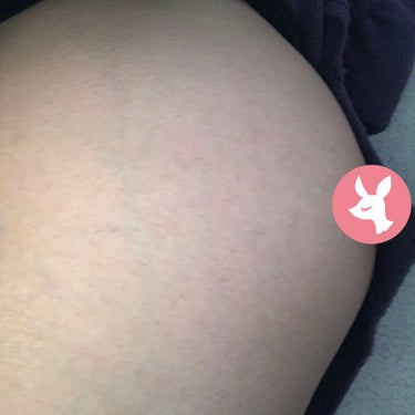 エルバビーバ ベビーバターのクチコミ「ただいま妊娠9ヶ月(32週目)🕺
いまだに妊娠線は出来ておりません😚👍

ということでわたしの.....」（3枚目）