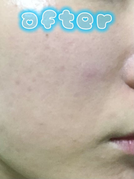 アスタリフトBBクリーム/アスタリフト/BBクリームを使ったクチコミ(4枚目)