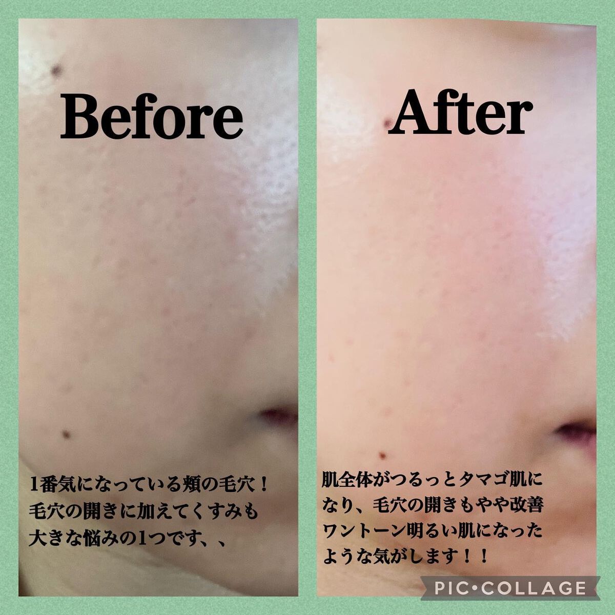 シカレチA エッセンス0.1/VT/美容液を使ったクチコミ（3枚目）