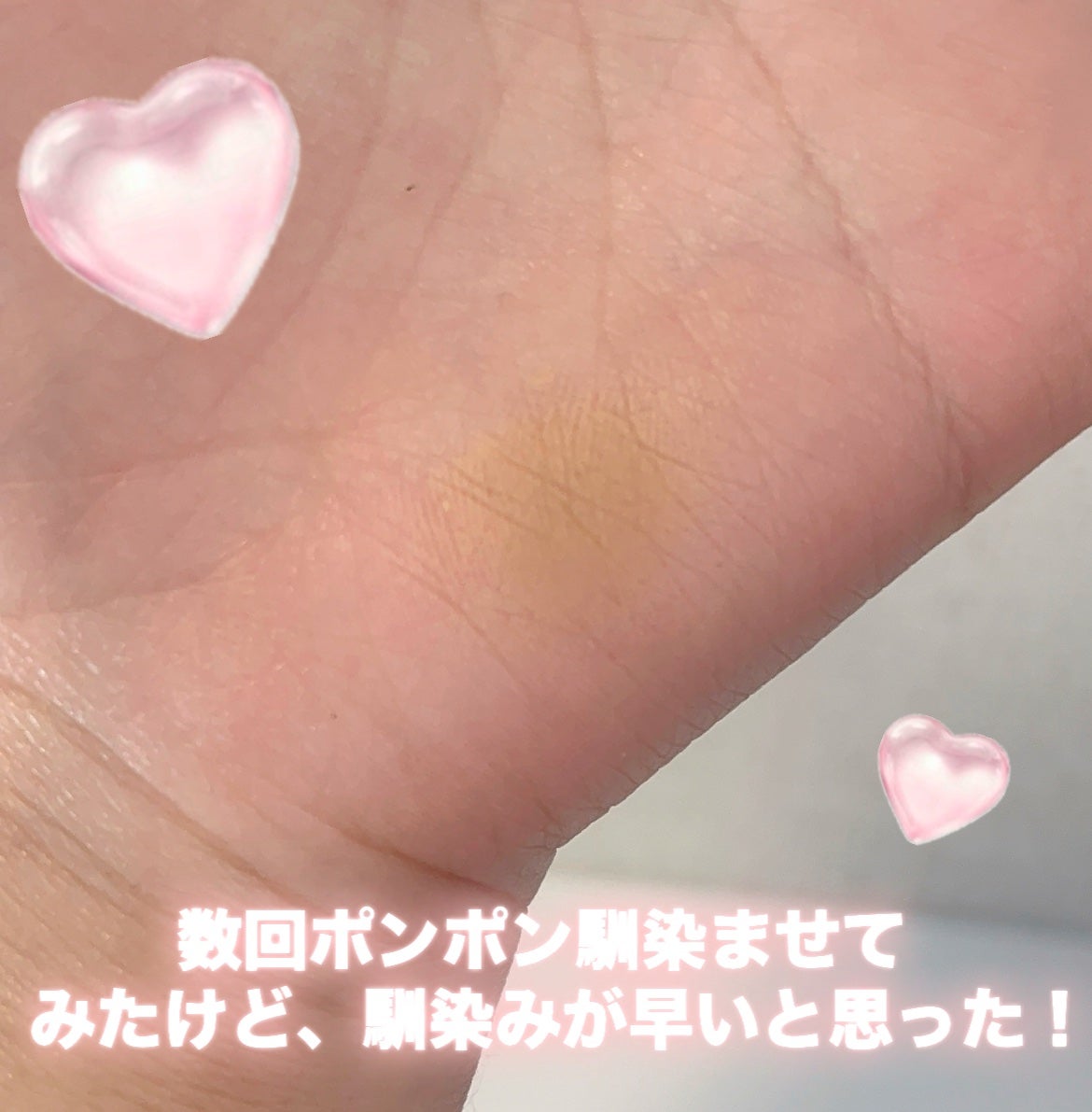 薬用コンシーラー アクネプロテクター/ONLY MINERALS/パウダーコンシーラーを使ったクチコミ(5枚目)