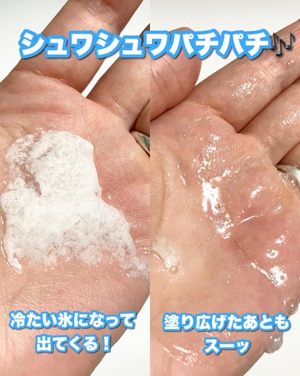 スノーアイススプレー ソレスカーラ72/SE:CRUNO/ボディローションを使ったクチコミ(3枚目)