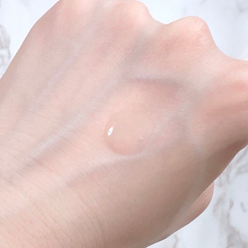 アクネケア ローション MB/d プログラム/化粧水を使ったクチコミ(3枚目)