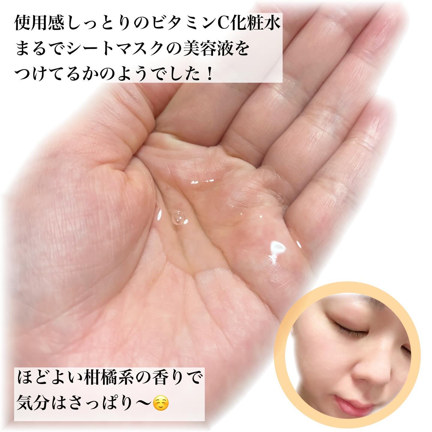 ダーマレーザー スーパーVC100ローション（しっとり）/クオリティファースト/化粧水を使ったクチコミ（2枚目）