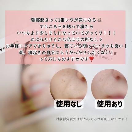 リンクルリペアしわパッチ/MARSHIQUE/その他スキンケアを使ったクチコミ(6枚目)