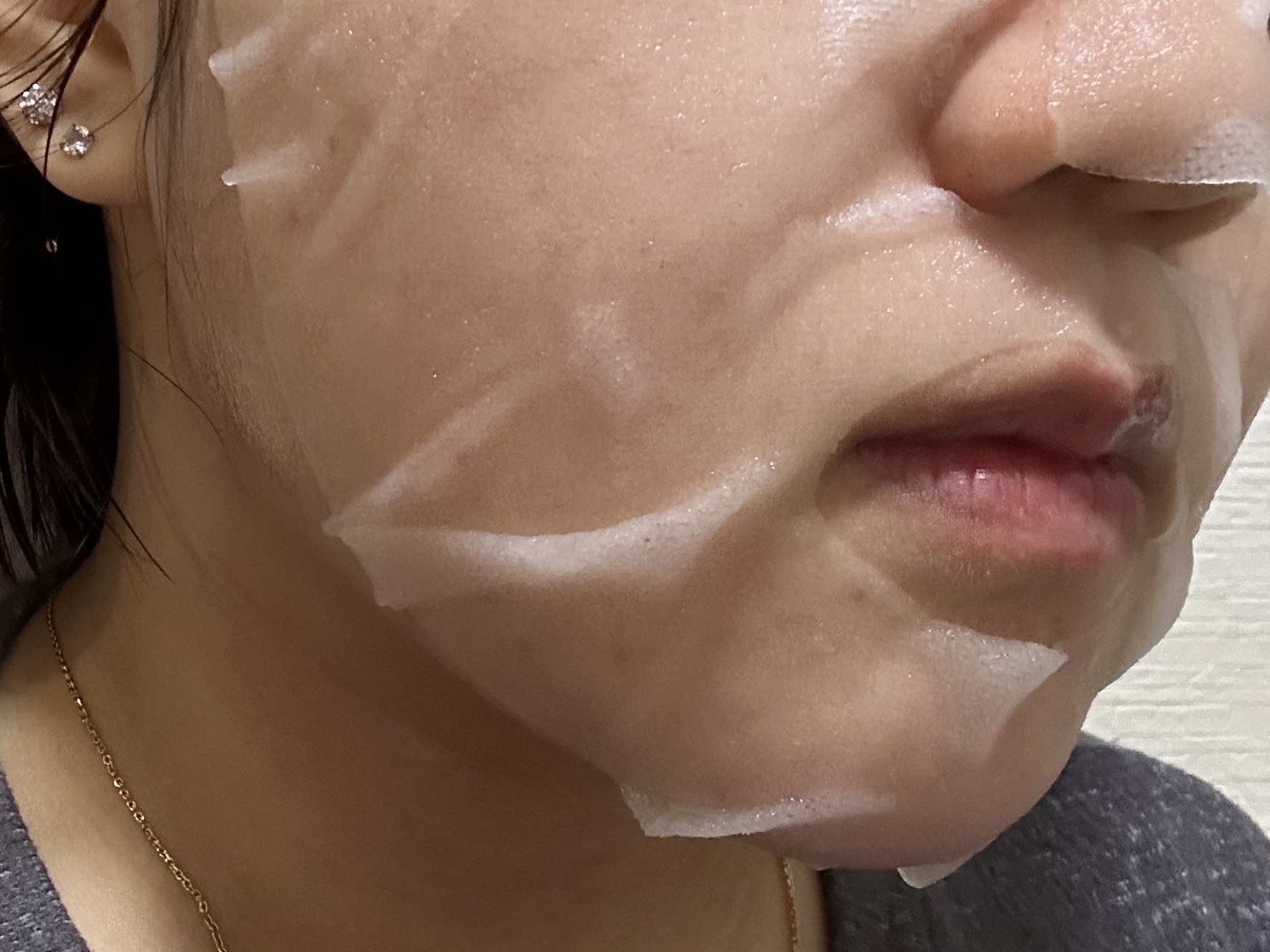 ダーマレーザー スーパーAZ100マスク/クオリティファースト/シートマスク・パックを使ったクチコミ（3枚目）