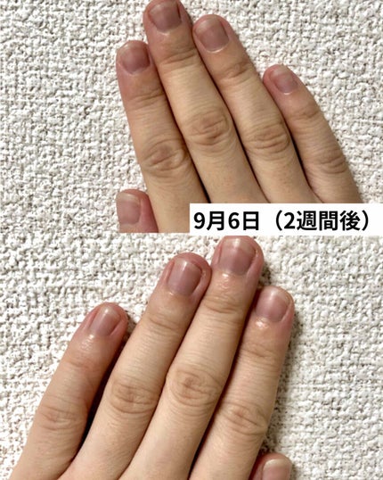 ネイルベッドオイル/アンドネイル/ネイルオイル・トリートメントを使ったクチコミ(3枚目)