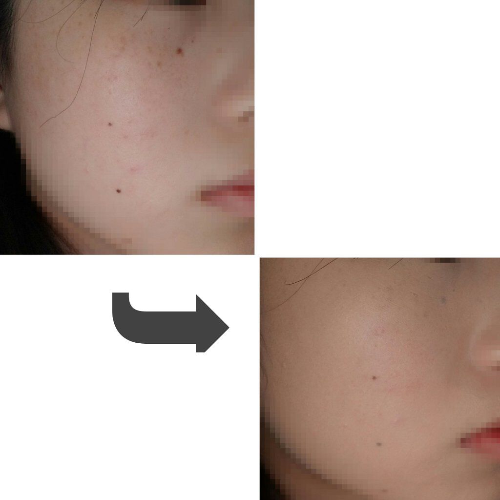 グロウ テンション/MISSHA/クッションファンデーションを使ったクチコミ(3枚目)