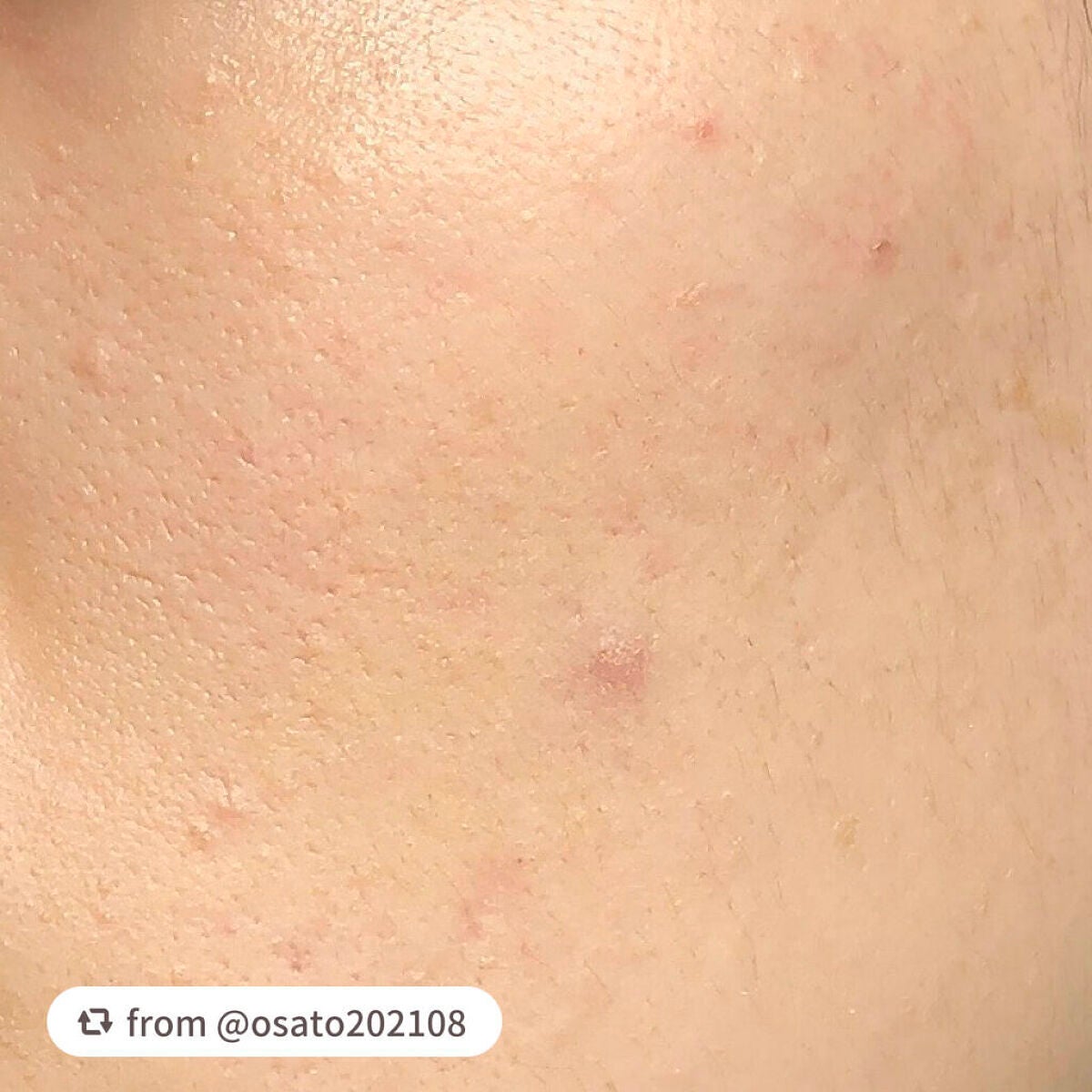 ネオクッション マット/LANEIGE/クッションファンデーションを使ったクチコミ(5枚目)