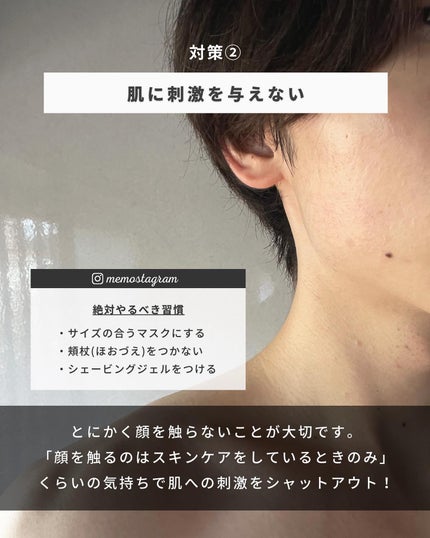 まえけん|ユニセックス美容 on LIPS 「@_mae.ken←ニキビを治してカッコよくなりたい男子はこち..」(6枚目)