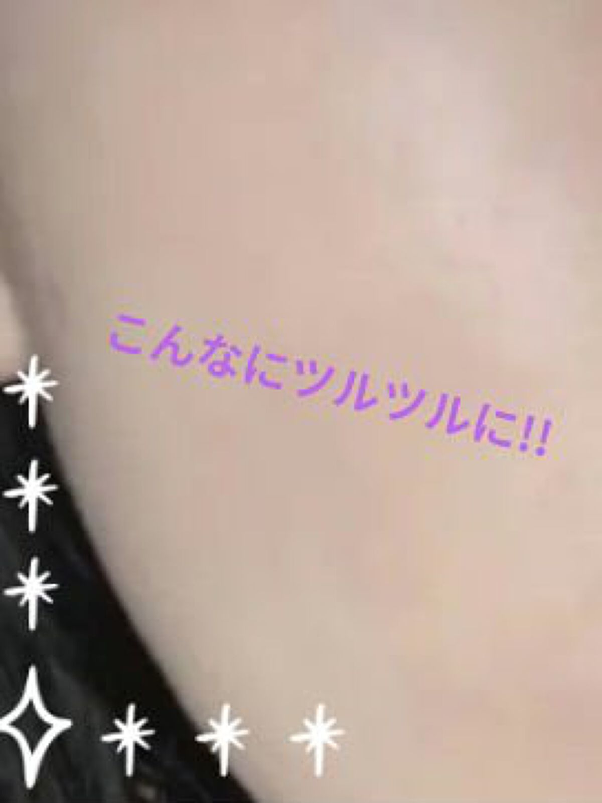 スキンケア洗顔料 薬用アクネケア/ビオレ/洗顔フォームを使ったクチコミ（3枚目）