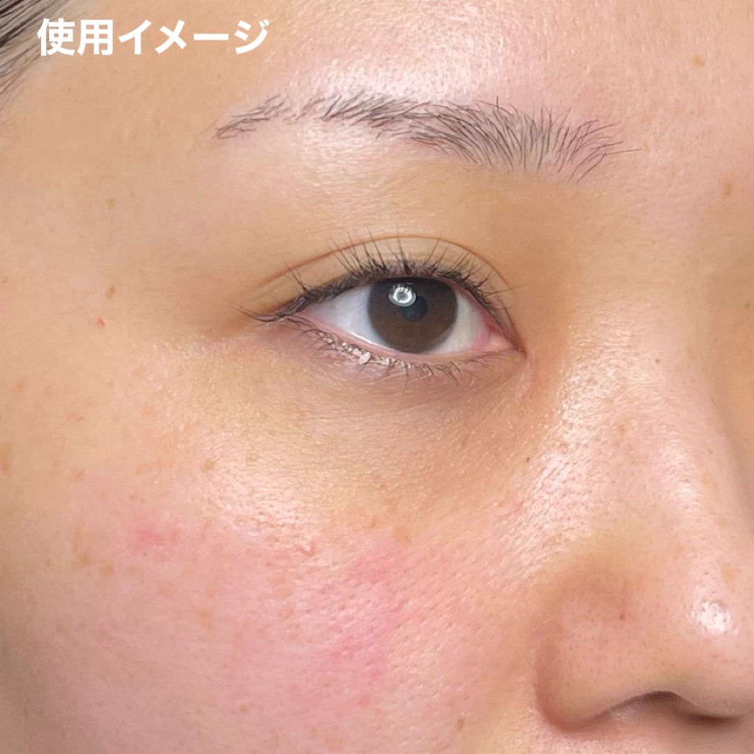 ACマグネシウムパッチ ミニ/スノーツープラス/にきびパッチを使ったクチコミ(9枚目)