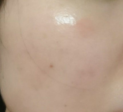 フォーエバー リブレイター Yセラム N/YVES SAINT LAURENT BEAUTE/美容液を使ったクチコミ(2枚目)