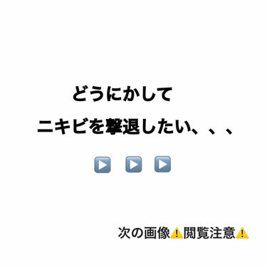 .
ニキビがあるとどうしても気になって触っちゃって気づいたら潰しちゃうことが多々、、
そのため大量のニキビと顔全体の赤みがほんとすごくて悩んでました😥

皮膚科には行きたいけどあまり外に出るのもな、、と