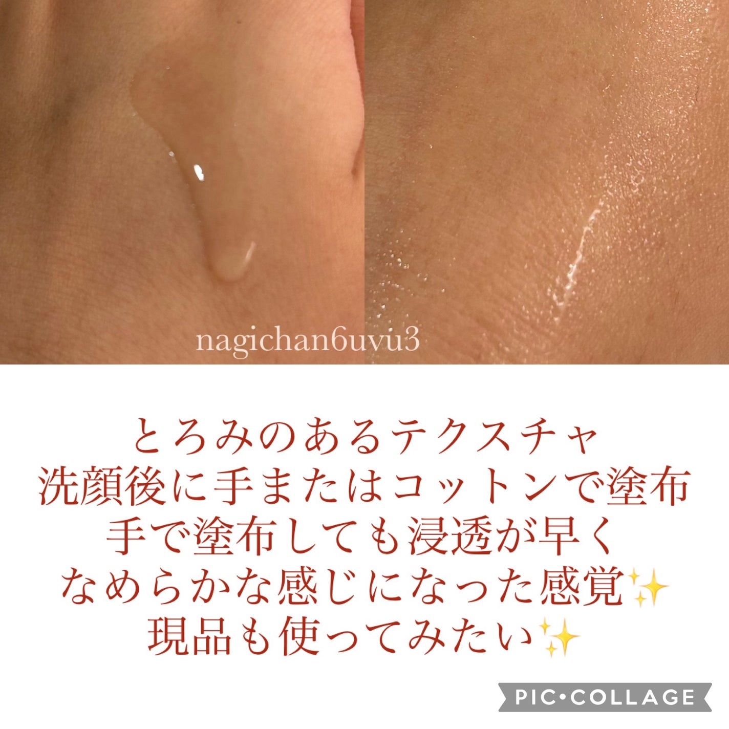 オイデルミン エッセンスローション/SHISEIDO/化粧水を使ったクチコミ(2枚目)