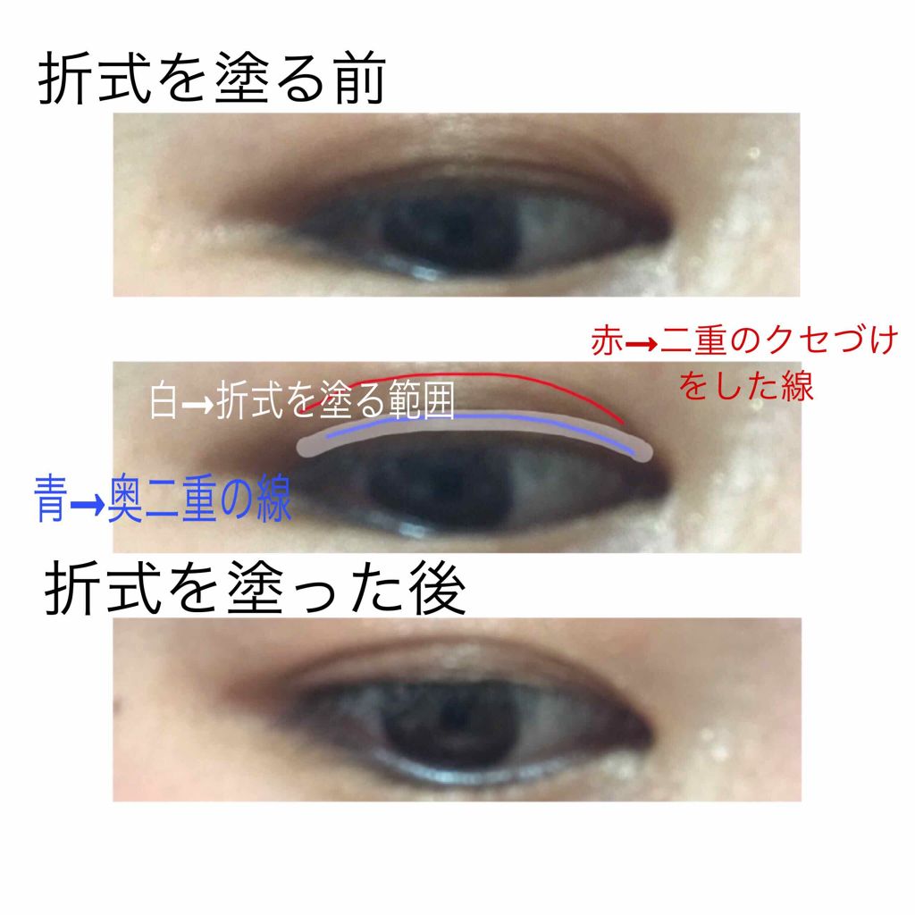 二重になる方法 オートマティックビューティ シングルアイテープ Automatic Beautyの使い方や二重メイク 夜アイプチしたら次の日 By おまめ 乾燥肌 10代後半 Lips