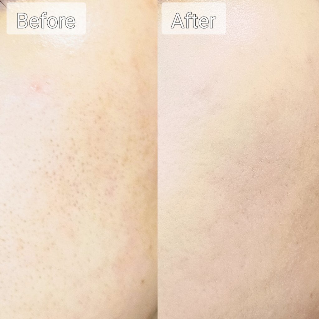 ピンクティーツリーカバーアップグロウクッション/APLIN/クッションファンデーションを使ったクチコミ(4枚目)