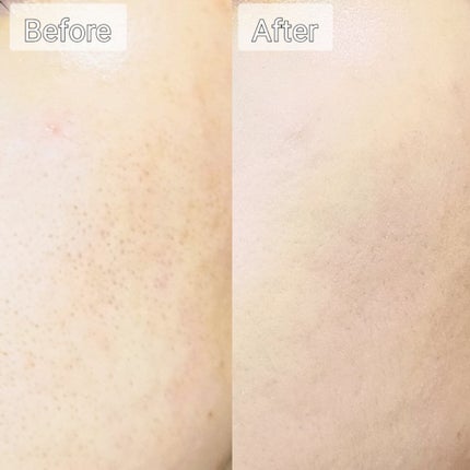 ピンクティーツリーカバーアップグロウクッション/APLIN/クッションファンデーションを使ったクチコミ(4枚目)