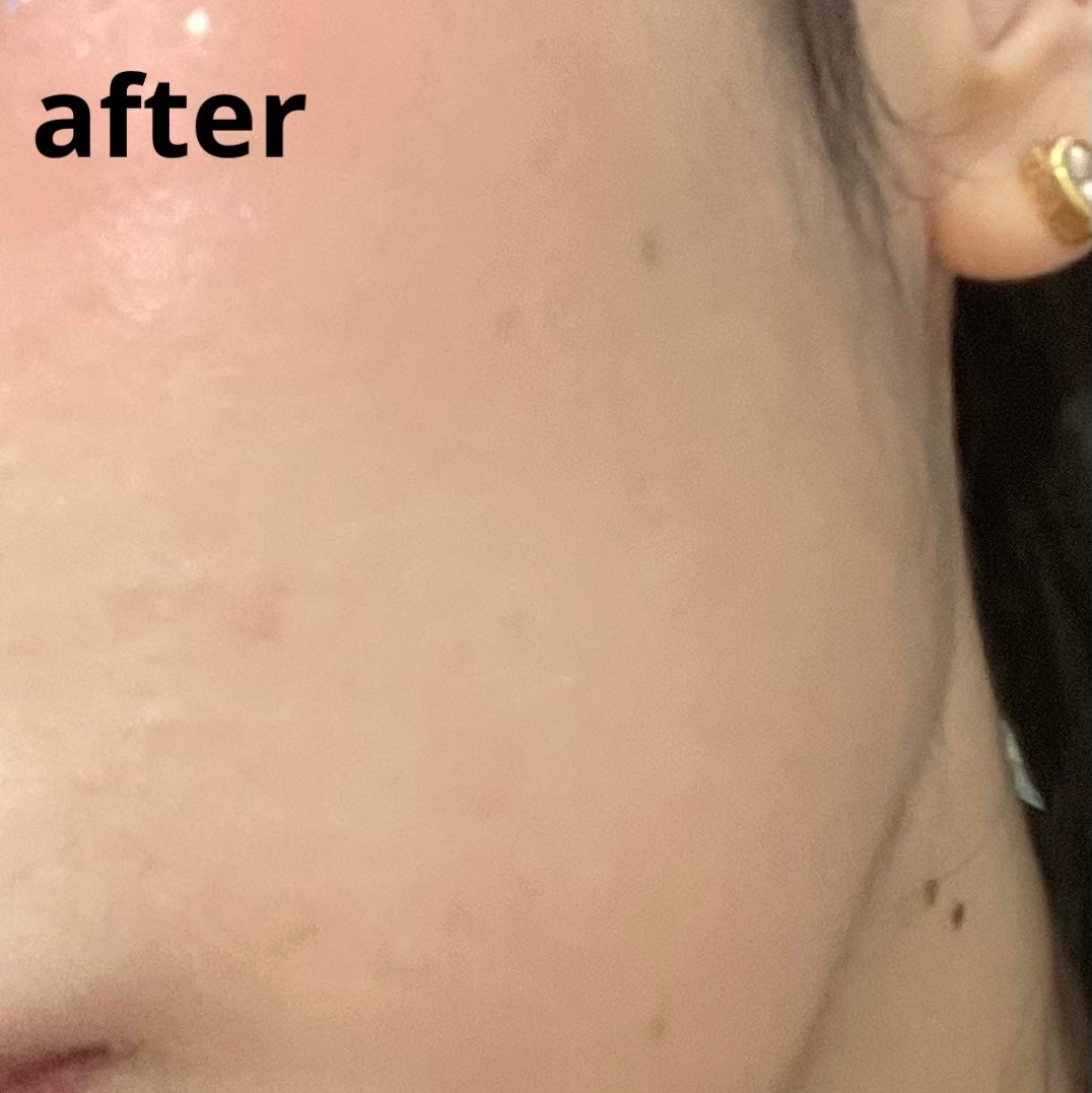 ブラック クッション/HERA/クッションファンデーションを使ったクチコミ(4枚目)