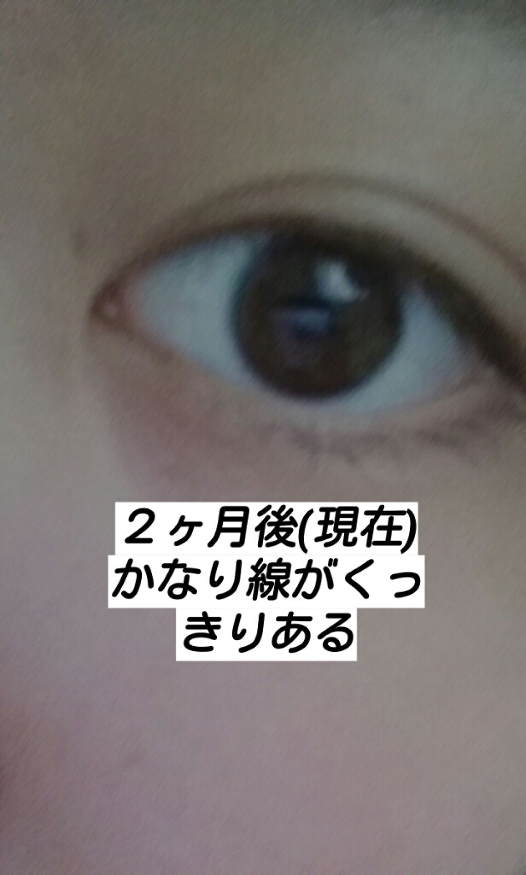 ダブルアイリキッド/Automatic Beauty/二重まぶた用アイテムを使ったクチコミ(4枚目)